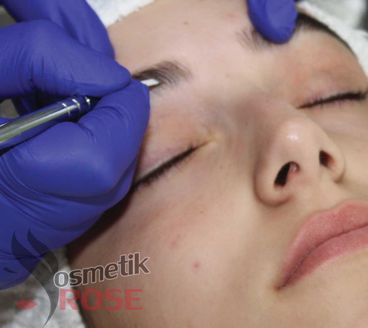 Microblading